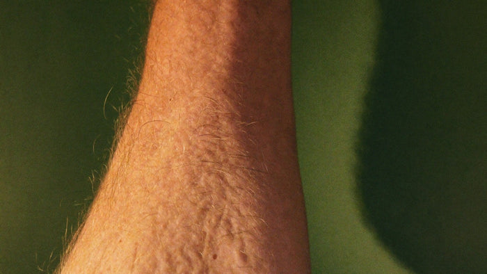 Close-up of a forearm with goosebumps and raised hairs in warm light against a dark green wall