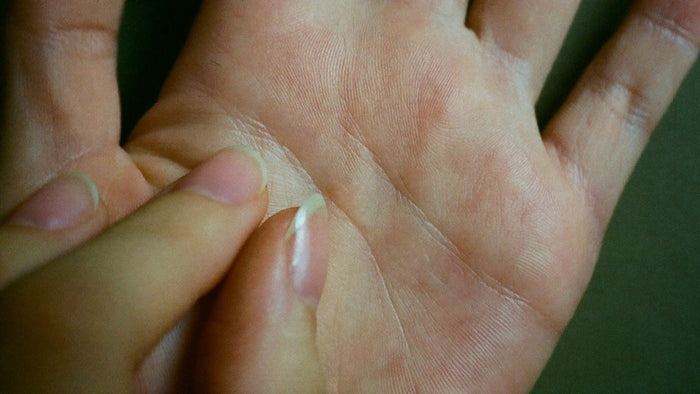 Close-up of fingernails scratching the lines of an itchy open palm, the folk sign said to mean money