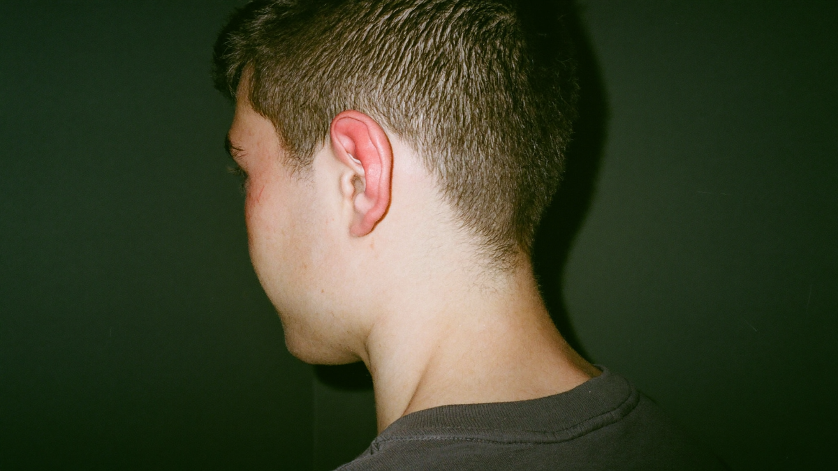 Young man seen from behind at an angle, one ear flushed bright red and hot, in front of a dark green wall