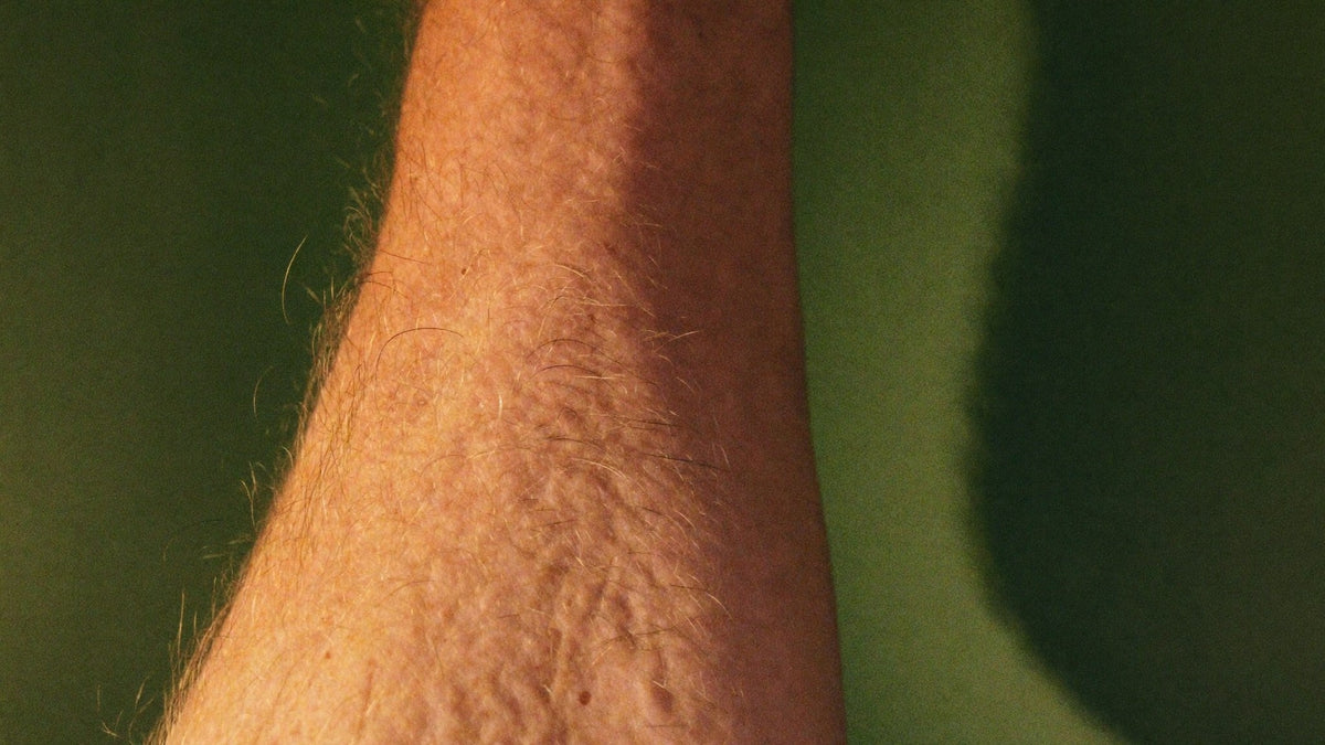 Close-up of a forearm with goosebumps and raised hairs in warm light against a dark green wall